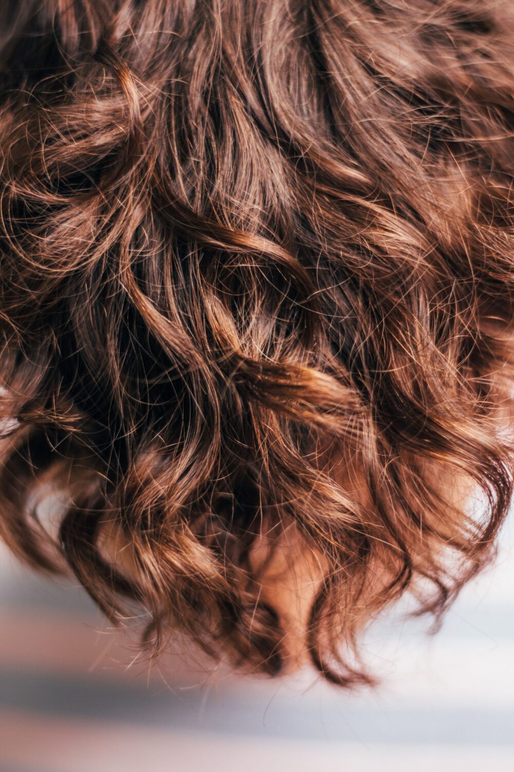 Przeszczep włosów - sposób na odzyskanie pięknej fryzury
