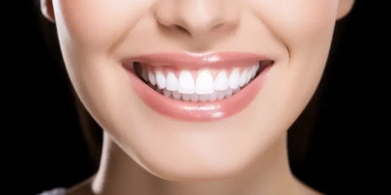 najlepszy-licowki-porcelanowe-szczecin-1