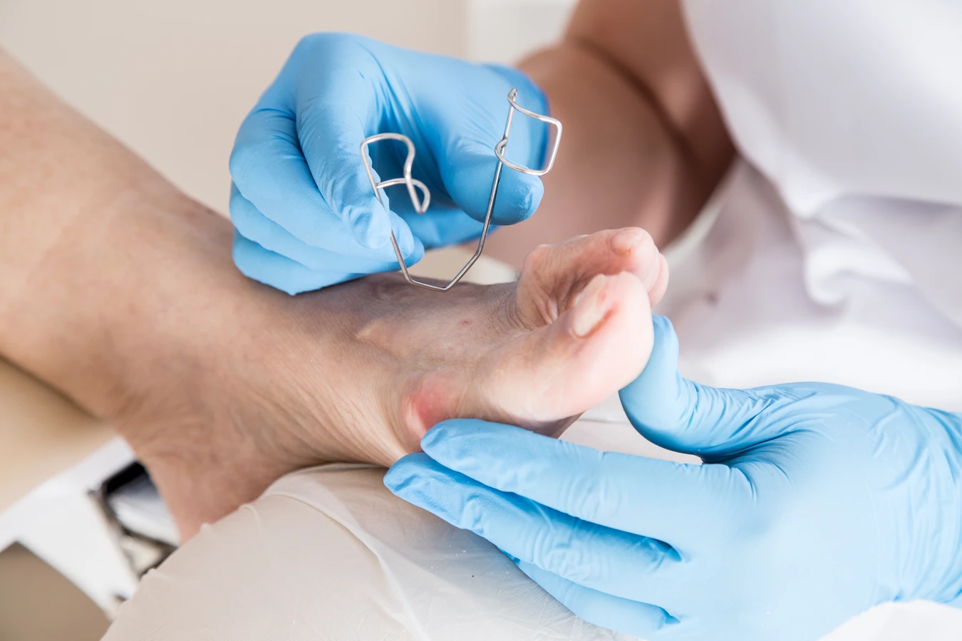 czym-jest-podologia-oraz-czym-dokladnie-zajmuje-sie-podolog-f